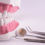 TMJ disorder treatment